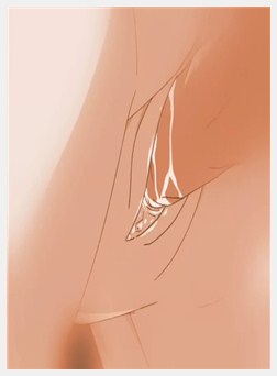 痴母前编